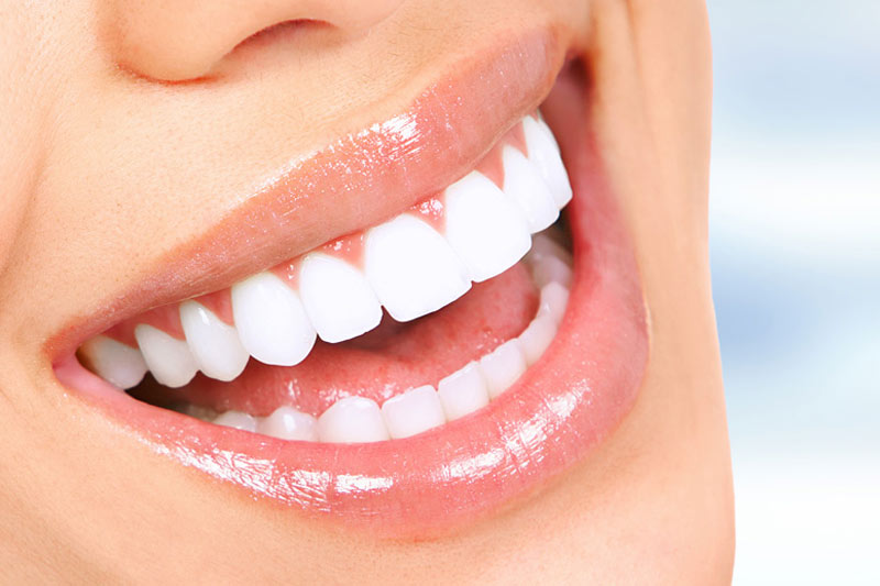 Cosmetic Dental Services in Kilgore